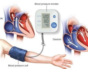 HYPERTENSION CHECKUP