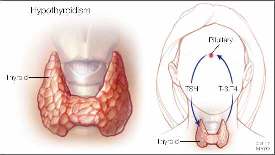 Diet-for-Hypothyroidism